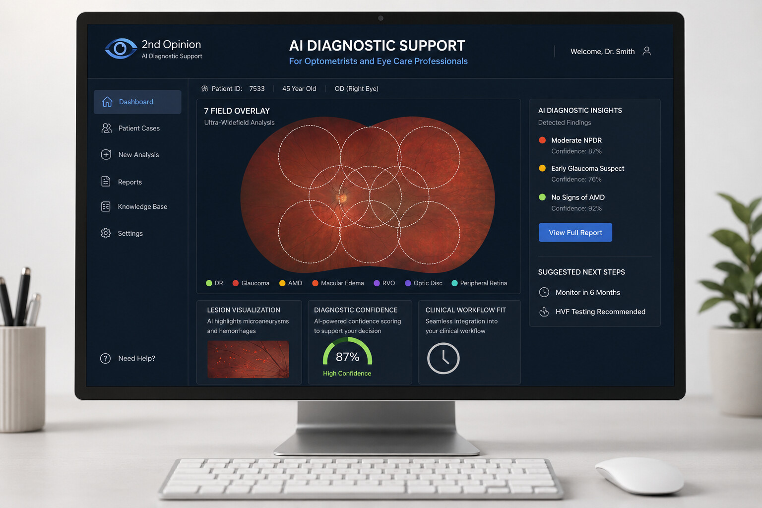 2nd Opinion AI Diagnostic Support — ultra-widefield scan with 7-field overlay
